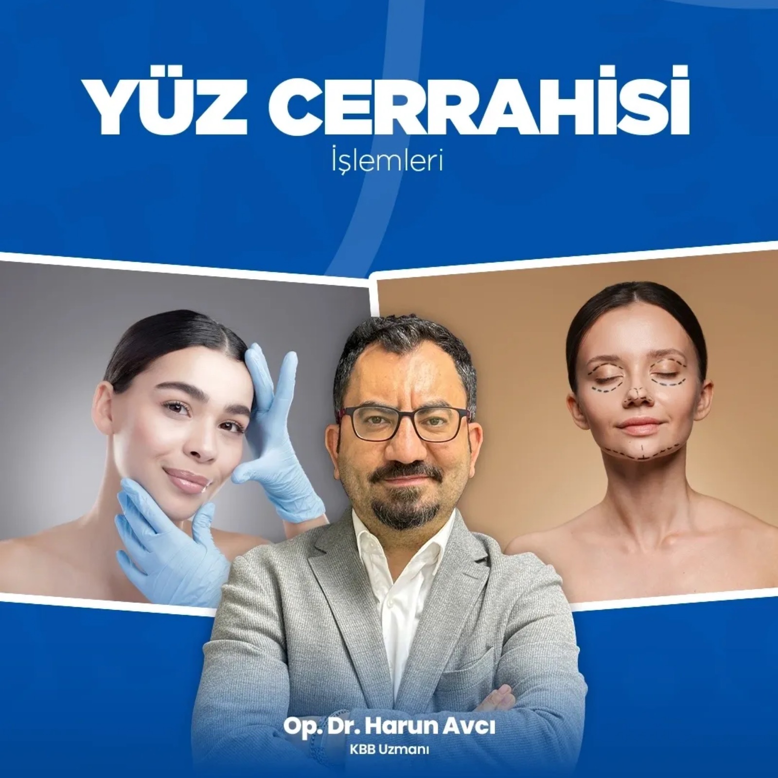 Yüz Cerrahisi İşlemleri: Hangi Estetik Uygulamalar Yapılır?
